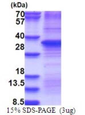 SDS-PAGE: Recombinant Human HGF His Protein [NBP2-51730]