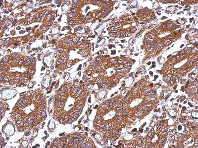 Immunohistochemistry-Paraffin: HAI-1/HGFA Inhibitor 1 Antibody [NBP2-16819]