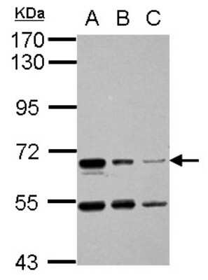 Western Blot: HAI-1/HGFA Inhibitor 1 Antibody [NBP2-16819]