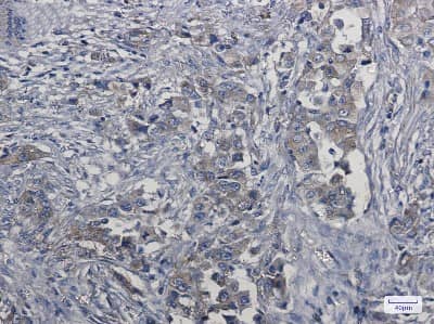 Immunohistochemistry-Paraffin: HGFR/c-MET Antibody (S02-4D6) [NBP3-14873]