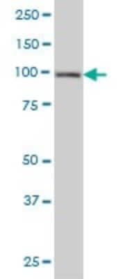 Western Blot: HGS Antibody (6D11) [H00009146-M01]