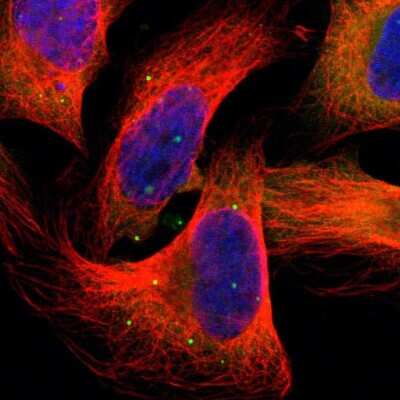 Immunocytochemistry/ Immunofluorescence: HGS Antibody [NBP1-83202]