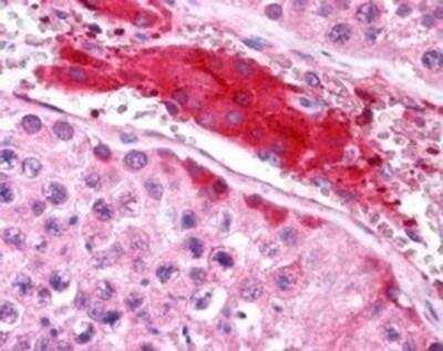 Immunohistochemistry-Paraffin: HGS Antibody [NB100-2839]