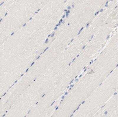 Immunohistochemistry-Paraffin: HGS Antibody [NBP1-83202]