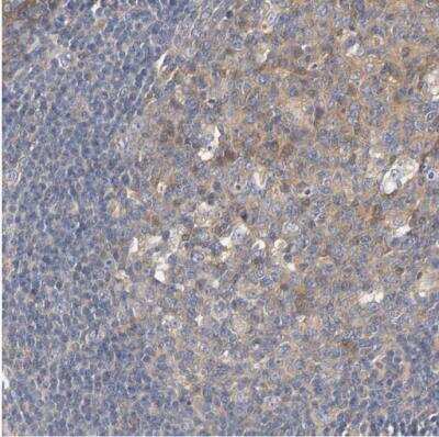 Immunohistochemistry-Paraffin: HGS Antibody [NBP1-83202]