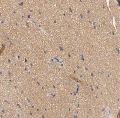 Immunohistochemistry-Paraffin: HGS Antibody [NBP1-83202]
