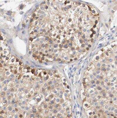 Immunohistochemistry-Paraffin: HGS Antibody [NBP1-83202]