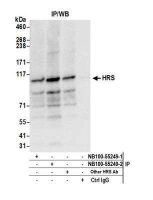 Immunoprecipitation: HGS Antibody [NB100-55249]