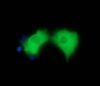 Immunofluorescence: HGS Antibody (OTI3H7) [NBP2-45734]