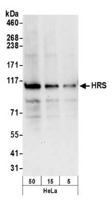 Western Blot: HGS Antibody [NB100-55249]