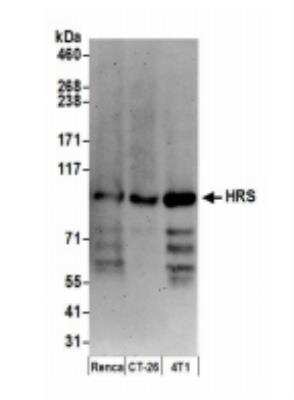 Western Blot: HGS Antibody [NB100-55249]