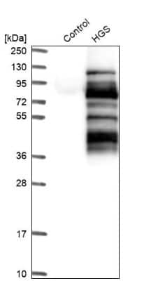 Western Blot: HGS Antibody [NBP1-83202]