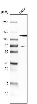 Western Blot: HGS Antibody [NBP1-83203]