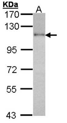 Western Blot: HGS Antibody [NBP2-16820]