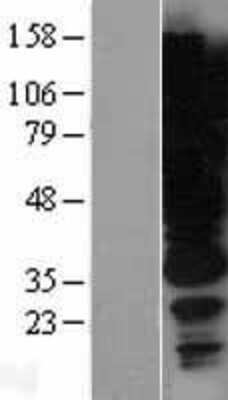 Western Blot: HGS Overexpression Lysate [NBP2-04275]