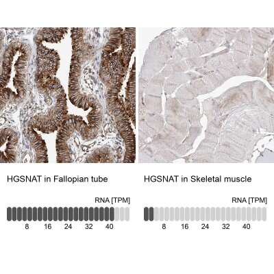 Immunohistochemistry-Paraffin: HGSNAT Antibody [NBP1-81990]