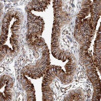Immunohistochemistry-Paraffin: HGSNAT Antibody [NBP1-81990]