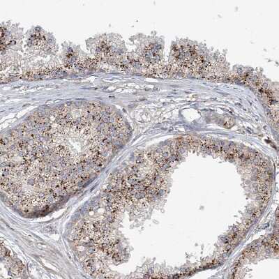Immunohistochemistry-Paraffin: HGSNAT Antibody [NBP1-81990]