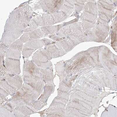 Immunohistochemistry-Paraffin: HGSNAT Antibody [NBP1-81990]