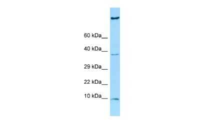 Western Blot: HGSNAT Antibody [NBP2-83038]