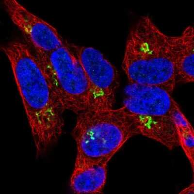 Immunocytochemistry/ Immunofluorescence: HHAT Antibody [NBP2-14089]