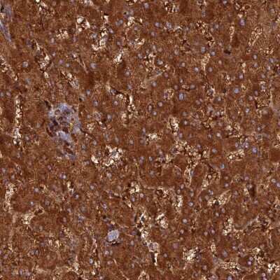 Immunohistochemistry-Paraffin: HHAT Antibody [NBP2-14089]