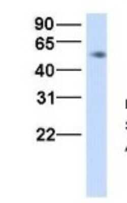 Western Blot: HHAT Antibody [NBP1-69465]