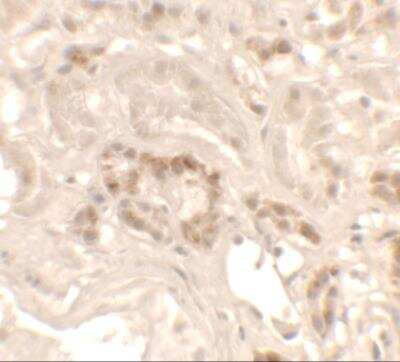 Immunohistochemistry: HHATL Antibody - BSA Free [NBP2-81952]