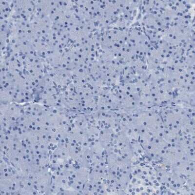 Immunohistochemistry-Paraffin: HHATL Antibody [NBP1-86791]