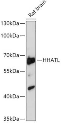 Western Blot: HHATL AntibodyAzide and BSA Free [NBP3-04745]