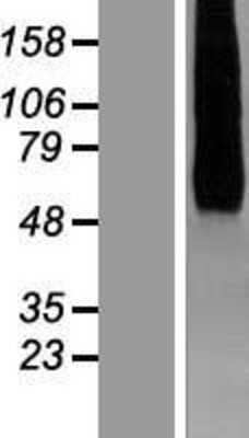 Western Blot: HHATL Overexpression Lysate [NBP2-06589]