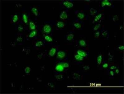 Immunocytochemistry/ Immunofluorescence: HHEX Antibody (1A5) [H00003087-M02]