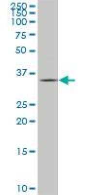 Western Blot: HHEX Antibody (1A5) [H00003087-M02]