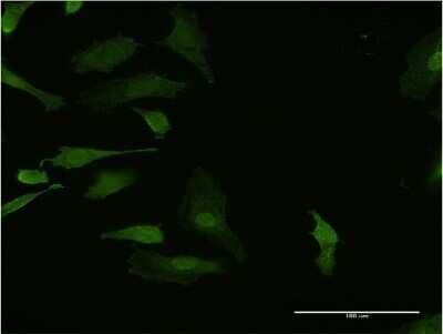 Immunocytochemistry/ Immunofluorescence: HHEX Antibody (2B12) [H00003087-M13]