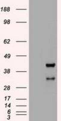 Western Blot: HHEX Antibody (OTI3E6) [NBP1-47792]