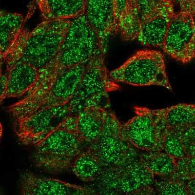 Immunocytochemistry/ Immunofluorescence: HHEX Antibody [NBP2-56110]