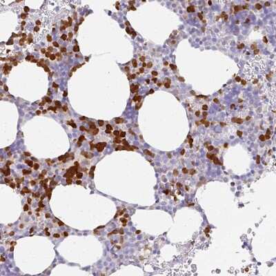 Immunohistochemistry-Paraffin: HHEX Antibody [NBP2-49024]