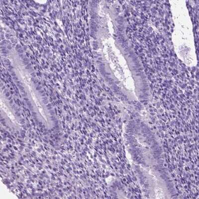 Immunohistochemistry-Paraffin: HHIP-Like 2 Antibody [NBP2-49302]