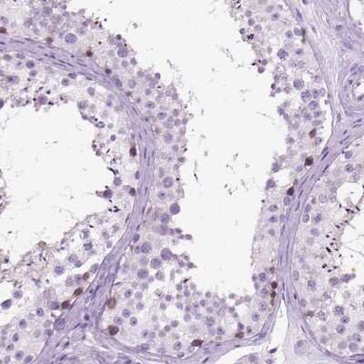 Immunohistochemistry-Paraffin: HHIP-Like 2 Antibody [NBP2-49302]