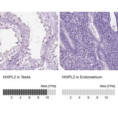 Immunohistochemistry-Paraffin: HHIP-Like 2 Antibody [NBP2-49302]