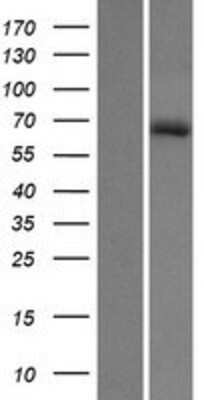 Western Blot: HHIPL1 Overexpression Lysate [NBP2-06023]