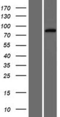 Western Blot: HHIPL1 Overexpression Lysate [NBP2-09440]