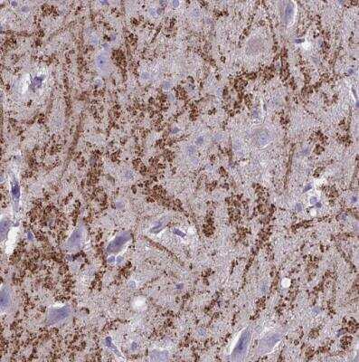 Immunohistochemistry-Paraffin: HHLA1 Antibody [NBP2-32420]