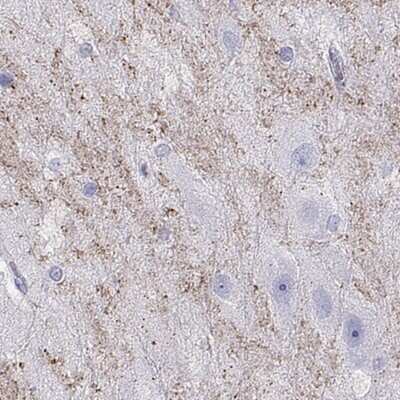 Immunohistochemistry-Paraffin: HHLA1 Antibody [NBP2-32420]