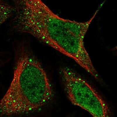 Immunocytochemistry/ Immunofluorescence: HHLA3 Antibody [NBP1-86331]