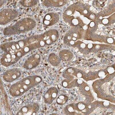 Immunohistochemistry-Paraffin: HHLA3 Antibody [NBP1-86331]