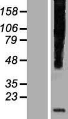 Western Blot: HHLA3 Overexpression Lysate [NBP2-07533]