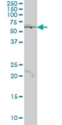 Western Blot: HHMJG Antibody (4E10) [H00008690-M01]