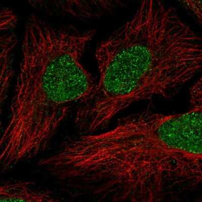 Immunocytochemistry/ Immunofluorescence: HHMJG Antibody [NBP2-68760]