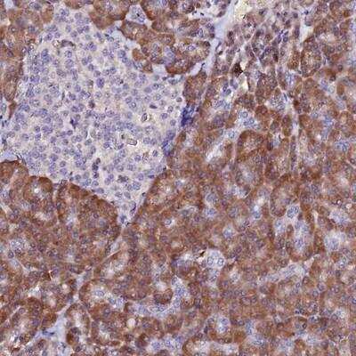 Immunohistochemistry-Paraffin: HHMJG Antibody [NBP1-91986]